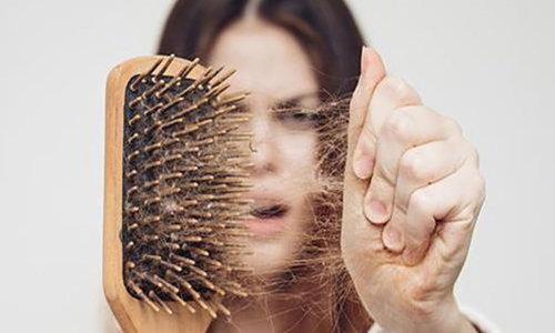 HAIR LOSS: A SYMPTOM WITH MULTI-FACTORY CAUSES