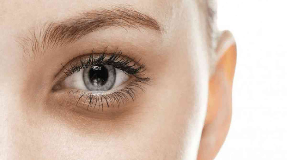 DARK EYE CIRCLES: TREATMENT BASED ON THE CAUSE