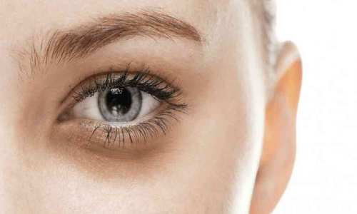 DARK EYE CIRCLES: TREATMENT BASED ON THE CAUSE
